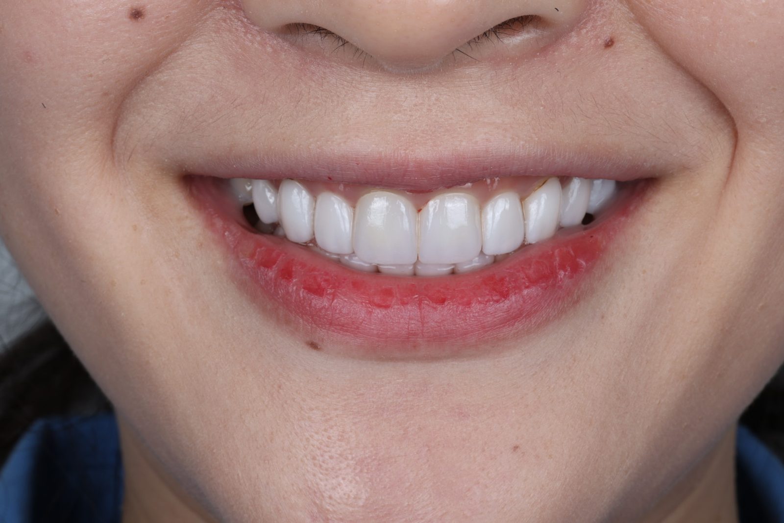 A confident, natural smile