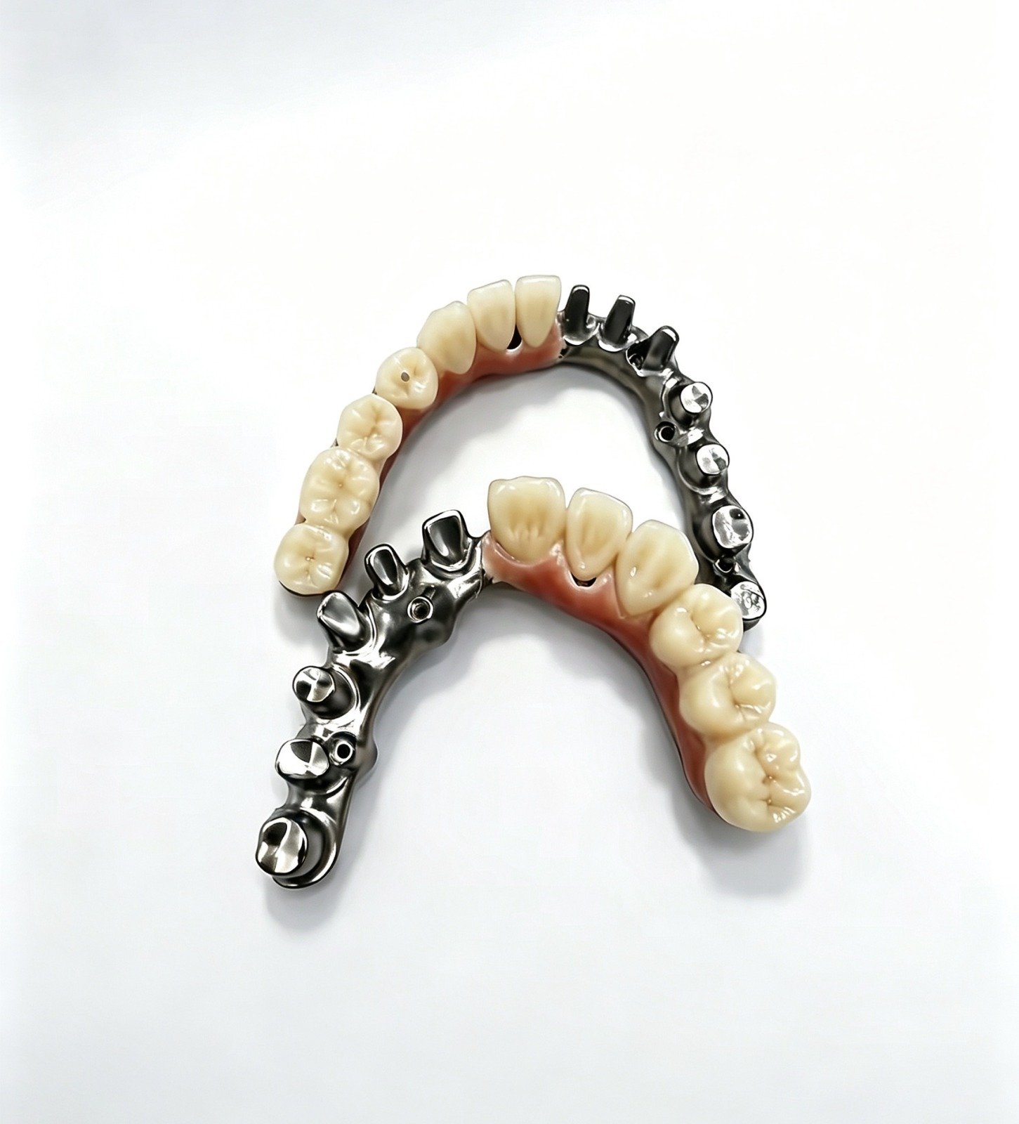 A full-arch All-on-X implant bridge showing the titanium framework and gum-tinted teeth